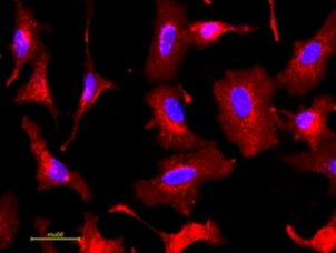 FITC-WFA荧光素标记紫藤凝集素（WFA，WFL），Fluorescein labeled Wisteria Floribunda Lectin (WFA, WFL)
